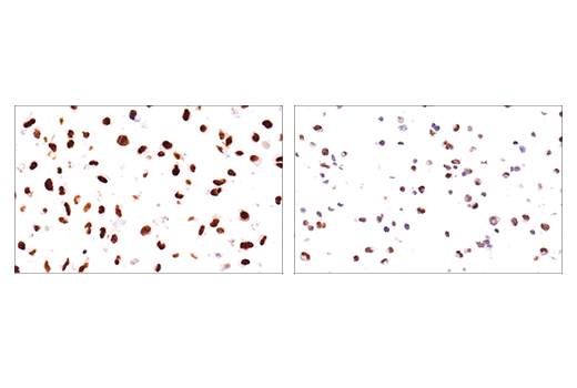 Immunohistochemistry Image 7: PML (E6S9L) Rabbit Monoclonal Antibody