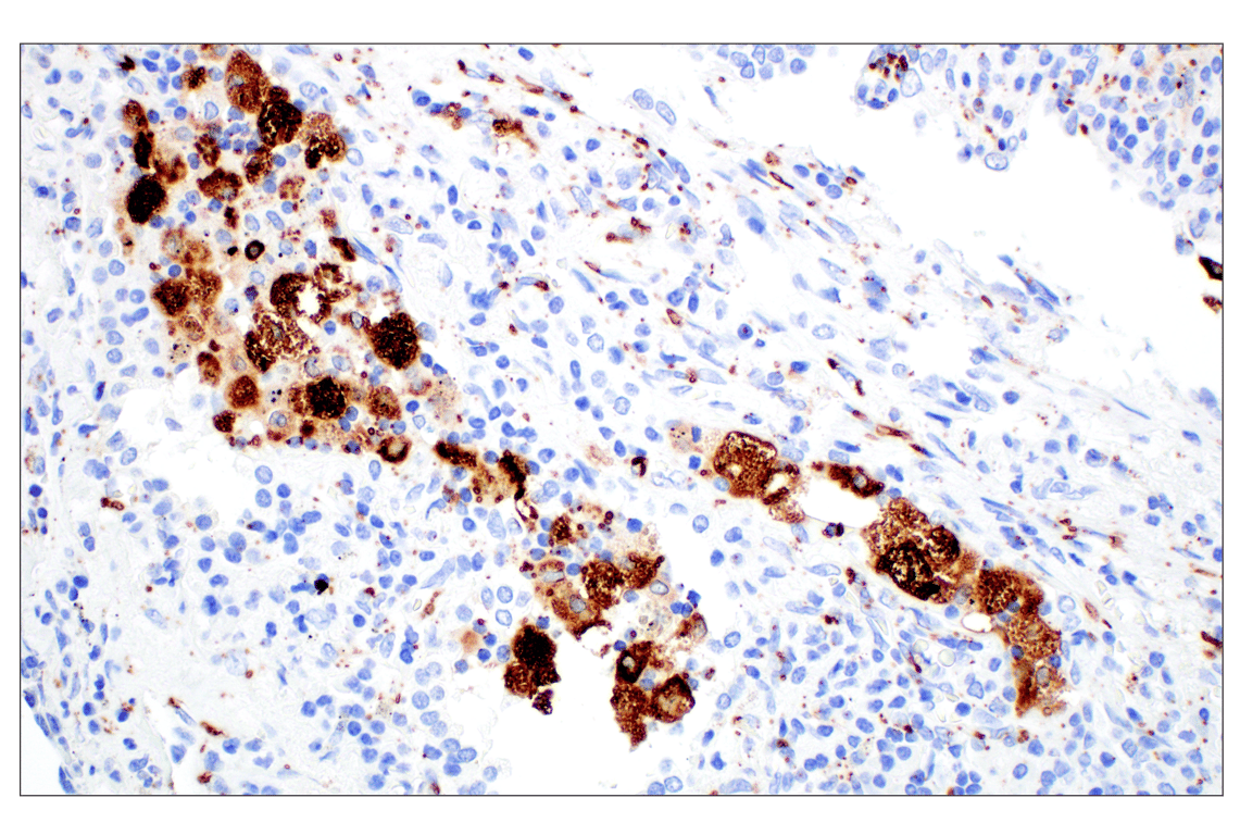 Immunohistochemistry Image 1: Perilipin-2 (E6G6M) Rabbit Monoclonal Antibody