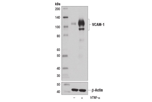 Western Blotting Image 2: VCAM-1 (E1E8X) Rabbit Monoclonal Antibody