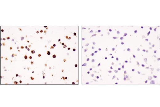Immunohistochemistry Image 4: TIM-3 (D5D5R<sup>™</sup>) Rabbit Monoclonal Antibody