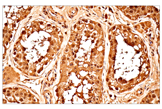 Immunohistochemistry Image 8: Ubiquitin (E6K4Y) Rabbit Monoclonal Antibody (BSA and Azide Free)