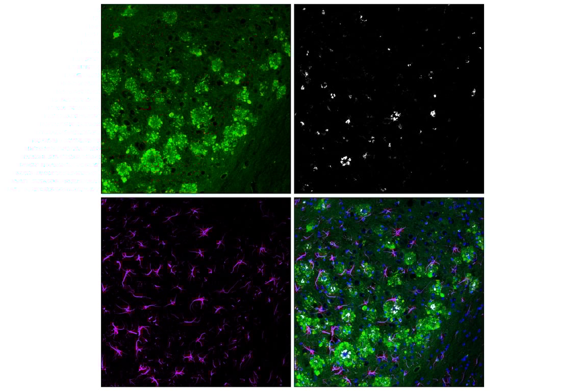 Immunofluorescence Image 2: Rab7 (E9O7E) Mouse Monoclonal Antibody (Alexa Fluor<sup>®</sup> 488 Conjugate)