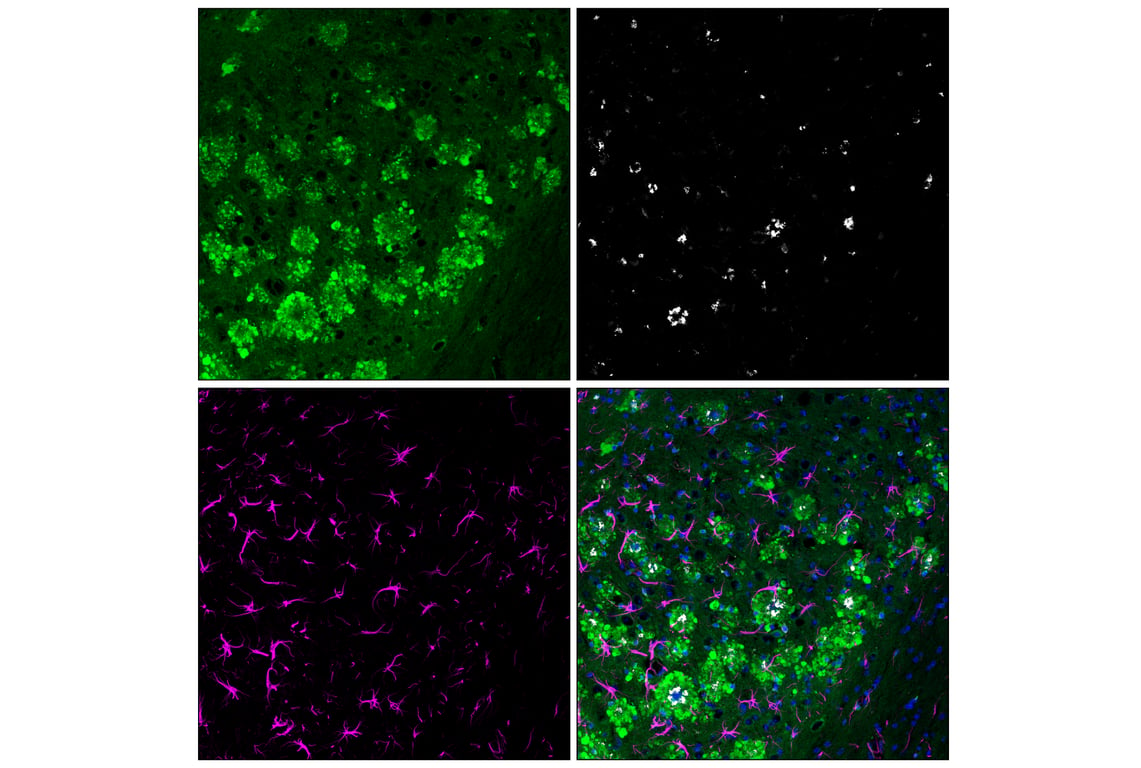 Immunofluorescence Image 2: Rab7 (E9O7E) Mouse mAb (Alexa Fluor<sup>®</sup> 488 Conjugate)