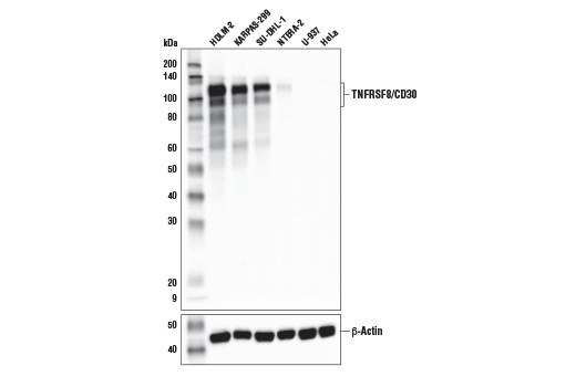 Western Blotting Image 2: TNFRSF8/CD30 (E7E4D) Rabbit Monoclonal Antibody