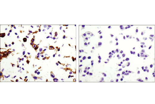 undefined Image 37: Epithelial-Mesenchymal Transition (EMT) Antibody Sampler Kit