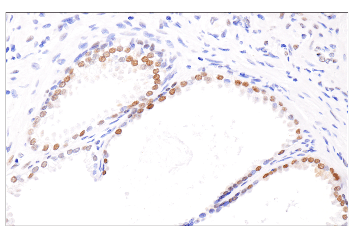 Immunohistochemistry Image 4: Phospho-Stat3 (Ser727) (D4X3C) Rabbit Monoclonal Antibody
