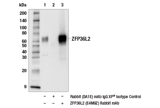 Immunoprecipitation Image 1: ZFP36L2 (E4M9Z) Rabbit Monoclonal Antibody