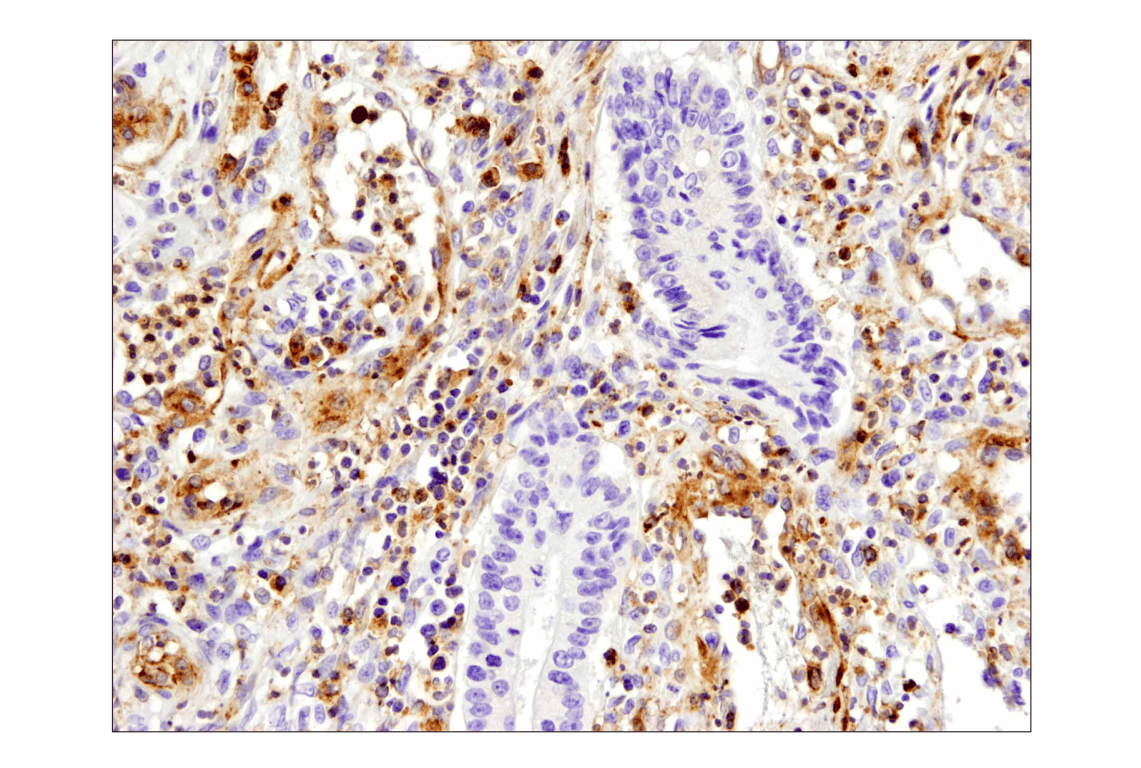 Immunohistochemistry Image 4: VISTA (D1L2G) Rabbit Monoclonal Antibody