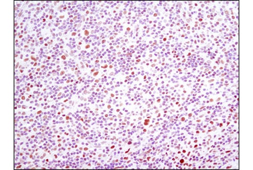 undefined Image 32: IRF Family Antibody Sampler Kit