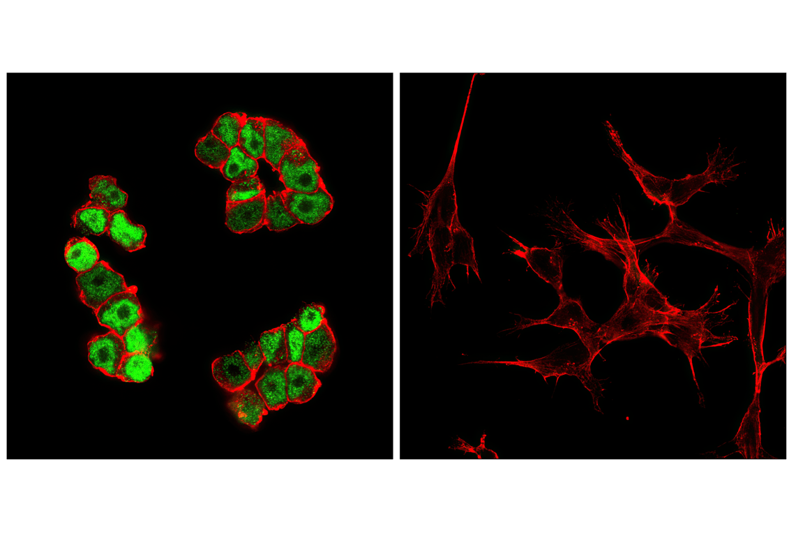 Immunofluorescence Image 1: c-Myc (E5Q6W) Rabbit Monoclonal Antibody