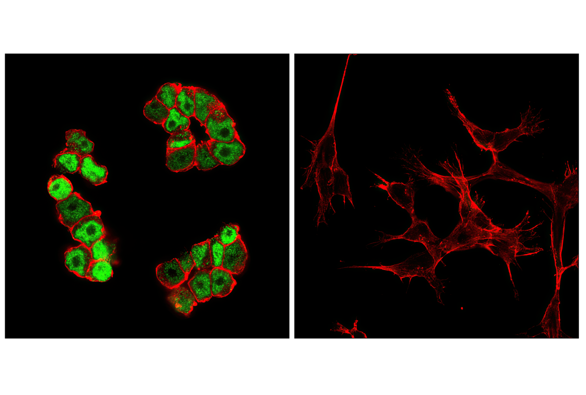 undefined Image 12: Myc Family Profiling Antibody Sampler Kit