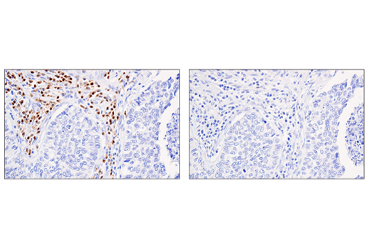 Immunohistochemistry Image 3: IRF-4 (E8H3S) XP<sup>®</sup> Rabbit mAb