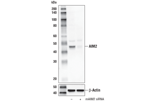 undefined Image 19: Mouse Reactive Inflammasome Antibody Sampler Kit