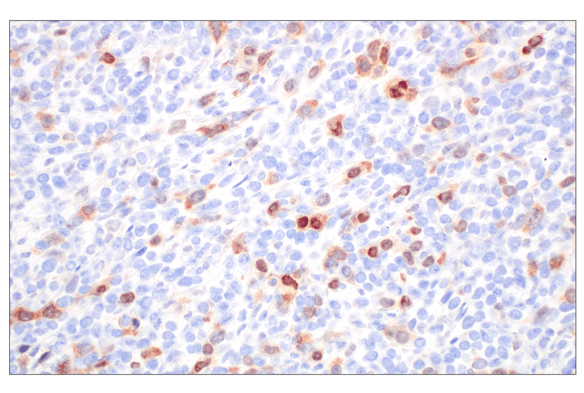 Immunohistochemistry Image 1: Cyclin A2 (E9Q5G) Rabbit mAb (BSA and Azide Free)