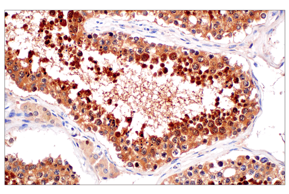Immunohistochemistry Image 5: PIP4K2C (E7P3S) Rabbit Monoclonal Antibody (BSA and Azide Free)
