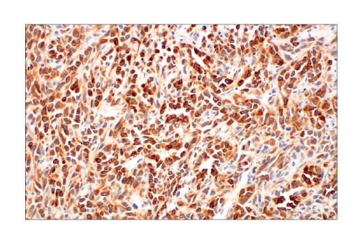 undefined Image 33: Pro-Apoptosis Bcl-2 Family Antibody Sampler Kit