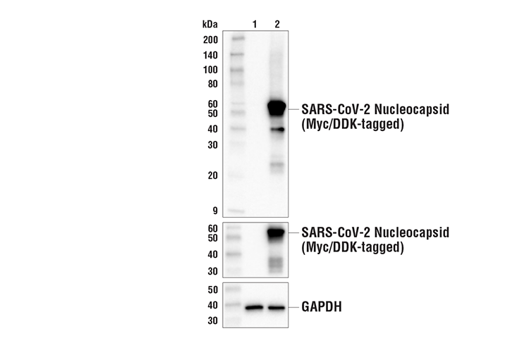 Western Blotting Image 3: SARS-CoV-2 Nucleocapsid Protein (E8R1L) Mouse Monoclonal Antibody