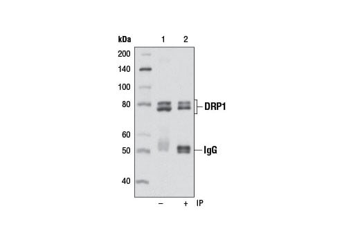 Immunoprecipitation Image 1: DRP1 (D8H5) Rabbit Monoclonal Antibody