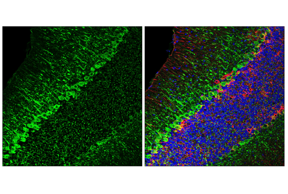 Immunofluorescence Image 2: Neurofilament-H (E9C9Z) Mouse Monoclonal Antibody