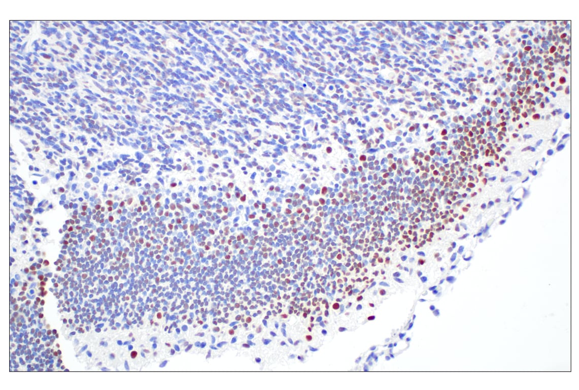 Immunohistochemistry Image 1: FOXG1 (E2W8P) Rabbit Monoclonal Antibody