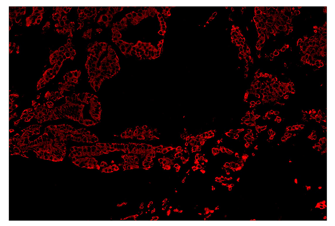 Immunohistochemistry Image 4: Pan-Keratin (Type I) (E6S1S) & CO-0072-750 SignalStar<sup>™</sup> Oligo-Antibody Pair