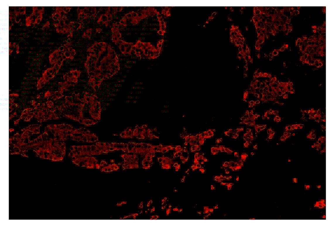 Immunohistochemistry Image 4: Pan-Keratin (Type I) (E6S1S) & CO-0072-647 SignalStar<sup>™</sup> Oligo-Antibody Pair
