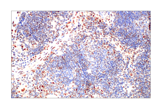 Immunohistochemistry Image 1: IRF-1 (D5E4) Rabbit Monoclonal Antibody (BSA and Azide Free)