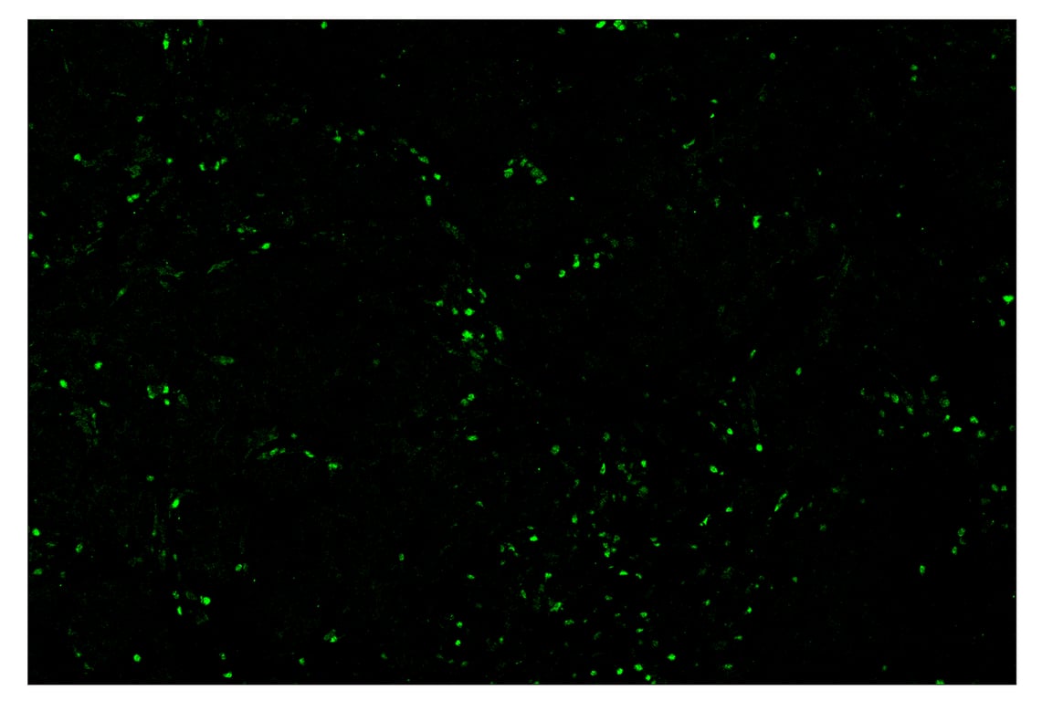 Immunohistochemistry Image 2: Tox/Tox2 (E6I3Q) & CO-0016-647 SignalStar<sup>™</sup> Oligo-Antibody Pair