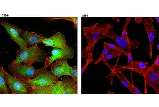 Immunofluorescence Image 1: NDRG1 (D8G9) Rabbit Monoclonal Antibody (BSA and Azide Free)
