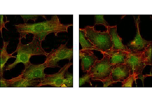 Immunofluorescence Image 1: p44/42 MAPK (Erk1/2) (L34F12) Mouse Monoclonal Antibody (BSA and Azide Free)