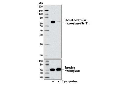 Western Blotting Image 2: Phospho-Tyrosine Hydroxylase (Ser31) (D6I9V) Rabbit Monoclonal Antibody