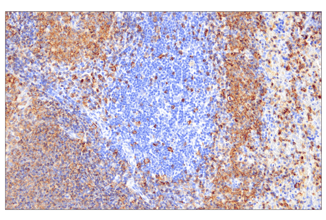 Immunohistochemistry Image 3: CD20 (E3N7O) Rabbit Monoclonal Antibody