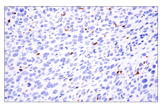 Immunohistochemistry Image 5: Ly-6G (E6Z1T) Rabbit Monoclonal Antibody