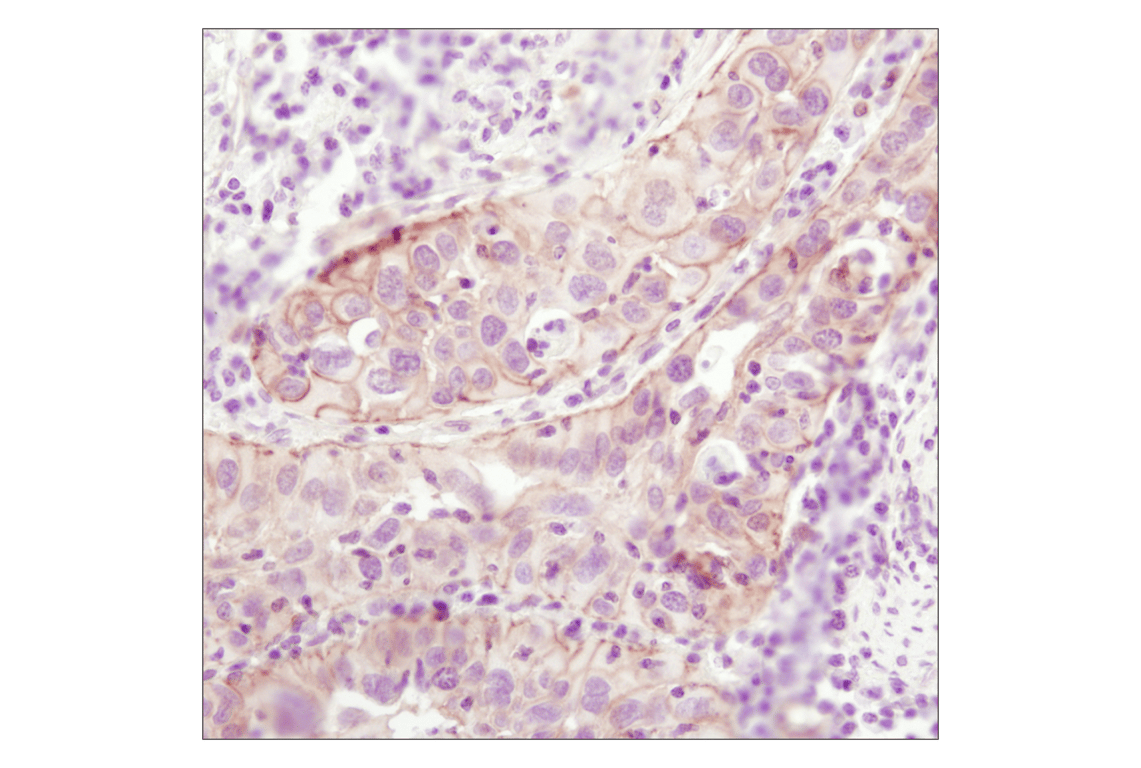 Immunohistochemistry Image 2: beta-Catenin (6B3) Rabbit Monoclonal Antibody