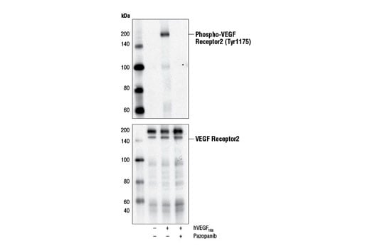 undefined Image 2: Pazopanib