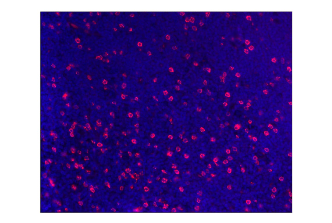 Immunohistochemistry Image 1: CD8α (D8A8Y) Rabbit mAb (Alexa Fluor<sup>®</sup> 555 Conjugate)