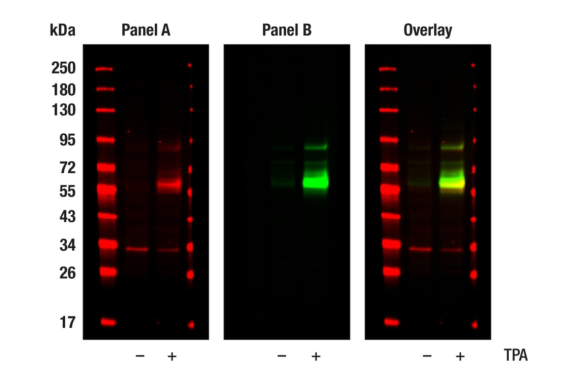 Western Blotting Image 1: c-Fos (E7L5L) Mouse Monoclonal Antibody