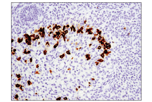 Immunohistochemistry Image 5: PD-1 (Intracellular Domain) (D7D5W) Rabbit Monoclonal Antibody