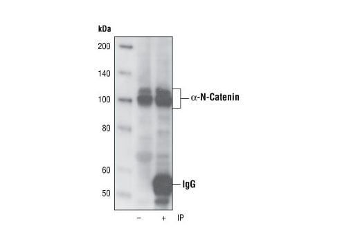 Immunoprecipitation Image 1: alpha-N-Catenin (C12G4) Rabbit Monoclonal Antibody
