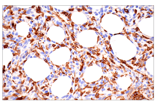 Immunohistochemistry Image 1: CD38 (E9F5A) Rabbit Monoclonal Antibody (BSA and Azide Free)