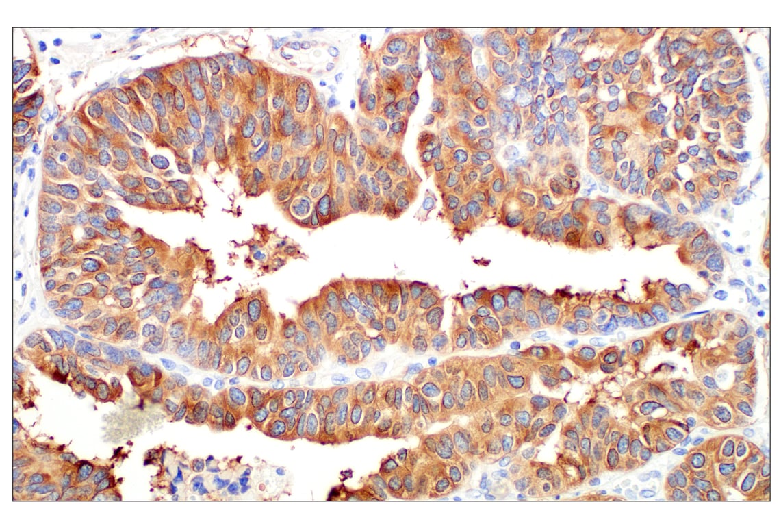 Immunohistochemistry Image 5: beta3-Tubulin (E9F3E) Mouse Monoclonal Antibody (BSA and Azide Free)