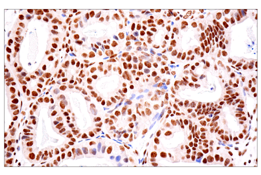 Immunohistochemistry Image 8: TDP43 (E2G6G) Rabbit Monoclonal Antibody