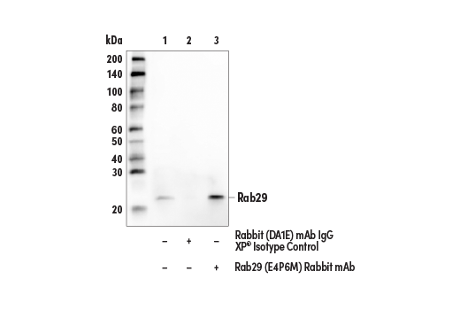 Immunoprecipitation Image 1: Rab29 (E4P6M) Rabbit Monoclonal Antibody