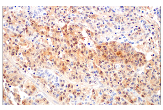 Immunohistochemistry Image 3: Caspase-1 (E4R8K) Rabbit Monoclonal Antibody