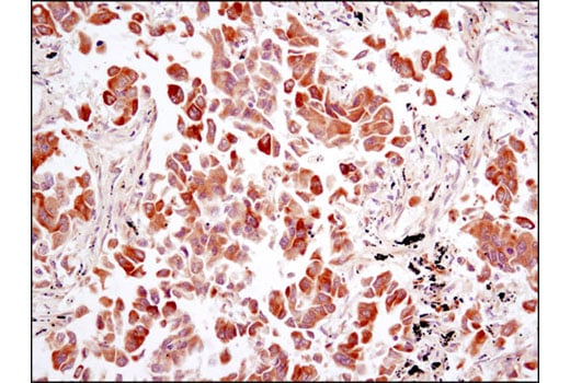 Immunohistochemistry Image 2: FGF Receptor 1 (D8E4) Rabbit Monoclonal Antibody (BSA and Azide Free)