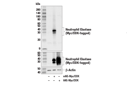 Western Blotting Image 2: Neutrophil Elastase (E6K6Q) Rabbit Monoclonal Antibody