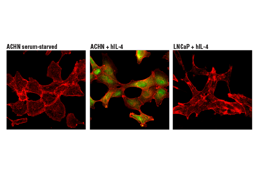 Immunofluorescence Image 1: Phospho-Stat6 (Tyr641) (D8S9Y) Rabbit Monoclonal Antibody (BSA and Azide Free)