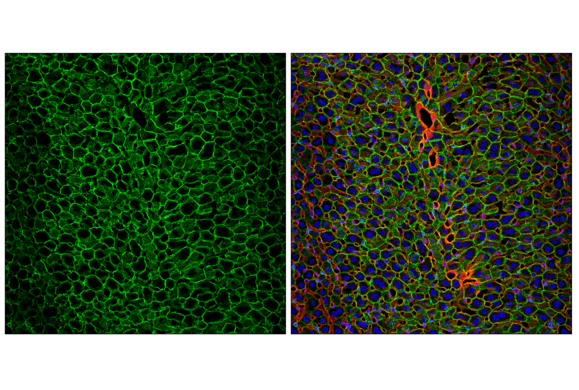 Immunofluorescence Image 1: N-Cadherin (D4R1H) Rabbit Monoclonal Antibody (Alexa Fluor<sup>®</sup> 488 Conjugate)