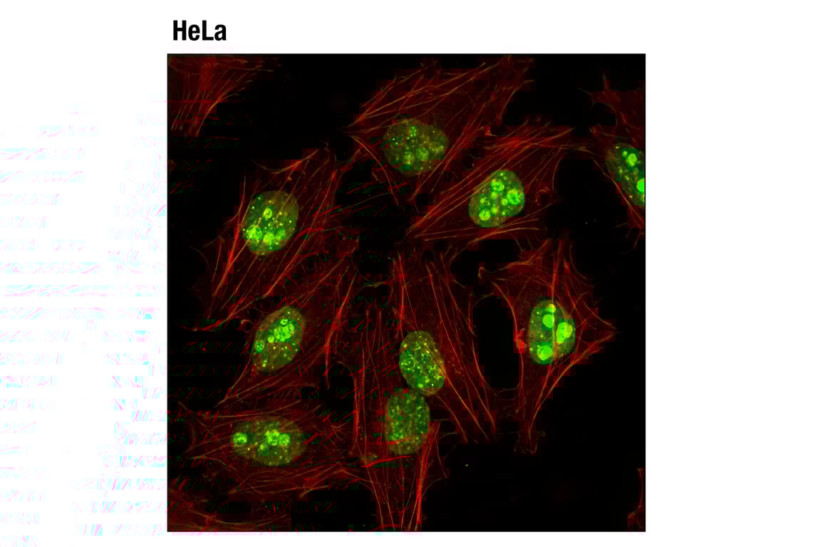 Immunofluorescence Image 1: Ki-67 (D3B5) Rabbit Monoclonal Antibody (Alexa Fluor<sup>®</sup> 488 Conjugate)