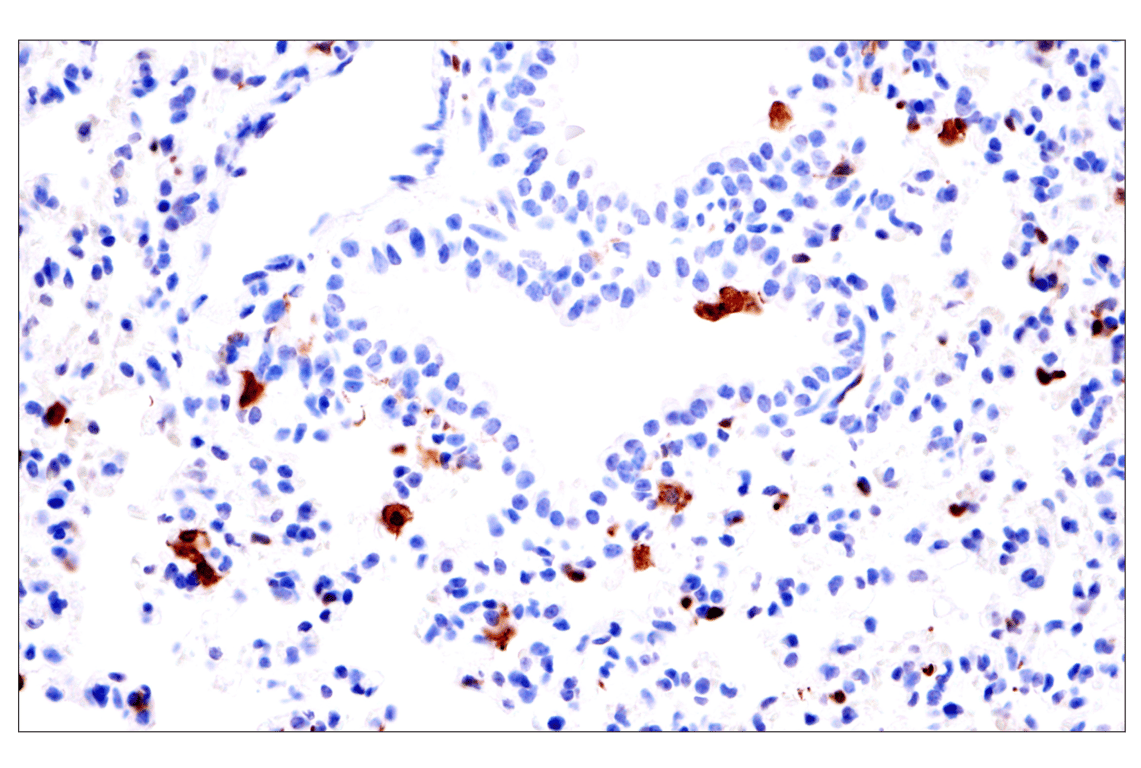 Immunohistochemistry Image 8: p47phox (F3Y6C) Rabbit Monoclonal Antibody (BSA and Azide Free)